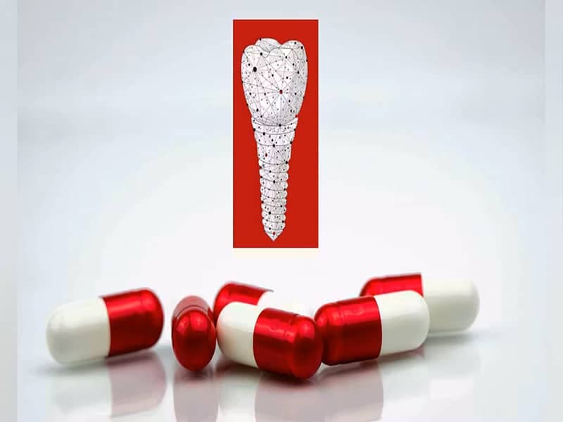 بعد از ایمپلنت چند روز آنتی‌بیوتیک بخوریم؟